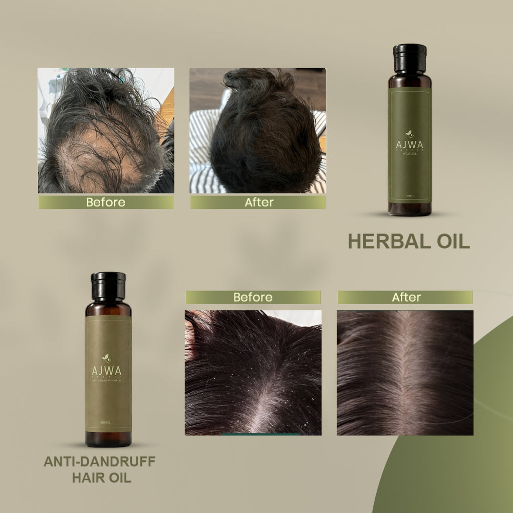 Ajwa Hair Care Bundle – Ultimate Hair Nourishment (Includes 2 Oils)